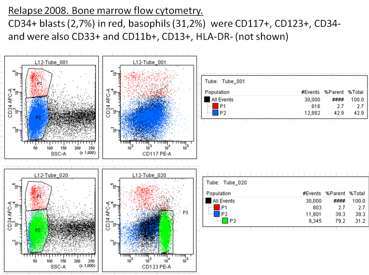 Fig 9. Bone marrow flow cytometry at relapse